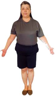 Hさん（接客業・52歳）ビフォー